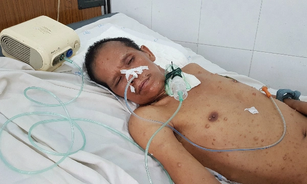 Sau hơn 2 tháng được y bác sĩ Bệnh viện Quân y 175 cưu mang chăm sóc, bệnh nhân vẫn chưa có người thân đến nhận. Ảnh: Lê Phương.