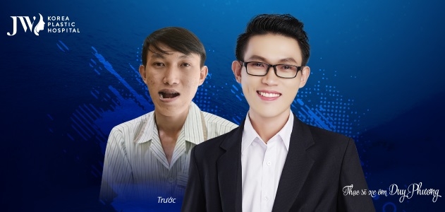 Thạc sĩ xe ôm Duy Phương tìm được công việc mới tại tập đoàn lớn sau phẫu thuật hàm móm.