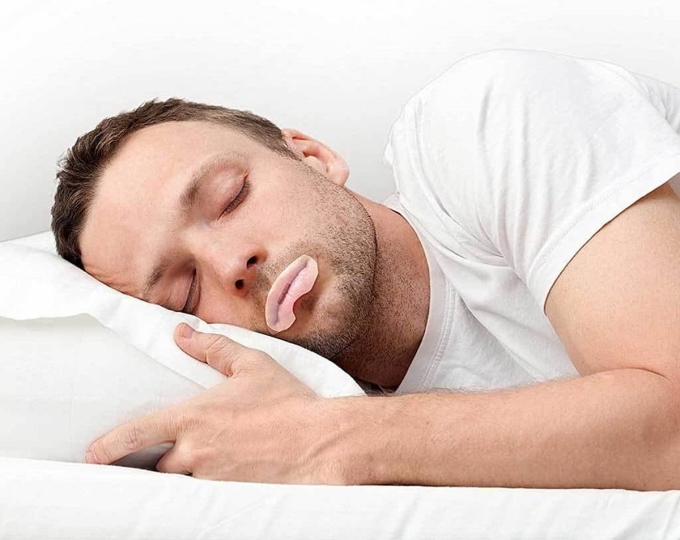 Một người đàn ông dán kín miệng khi ngủ. Ảnh: SnoreLab