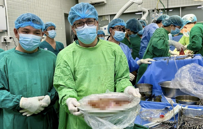 TS.BS Trần Công Duy Long và lá gan trước khi mổ tách đôi. Ảnh: Bệnh viện cung cấp