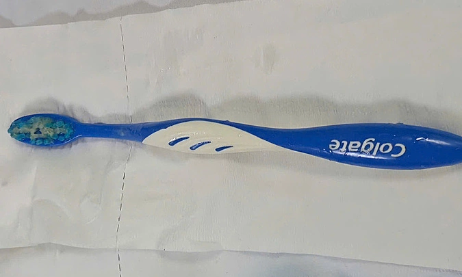 Cô gái nuốt bàn chải đánh răng 17 cm vào thực quản
