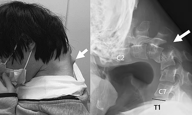 Game thủ 25 tuổi bị "rớt đầu" do nghiện điện thoại