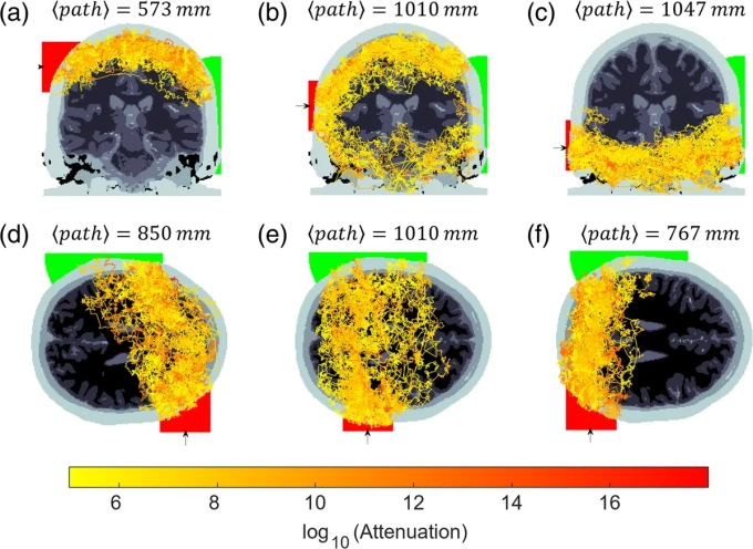 Mô phỏng các đường đi của photon trong não bộ. Ảnh: Neurophotonics