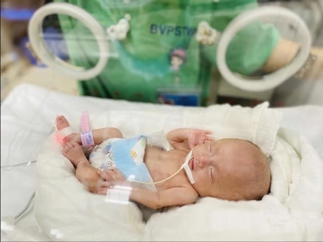 Y học hiện đại giúp nuôi sống trẻ sinh non nhỏ bằng bàn tay