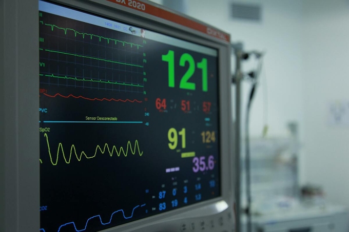 Monitor theo dõi sinh tồn tại bệnh viện. Ảnh: Pexel