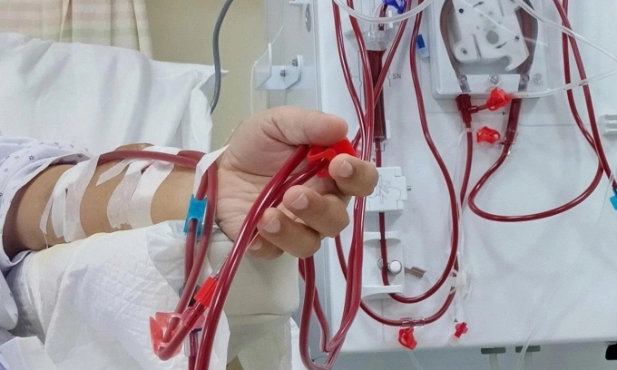 Bệnh nhân bị suy thận cấp do mắc sốt xuất huyết cần lọc máu liên tục nhiều giờ hoặc nhiều ngày. Ảnh minh họa: Đinh Tiên