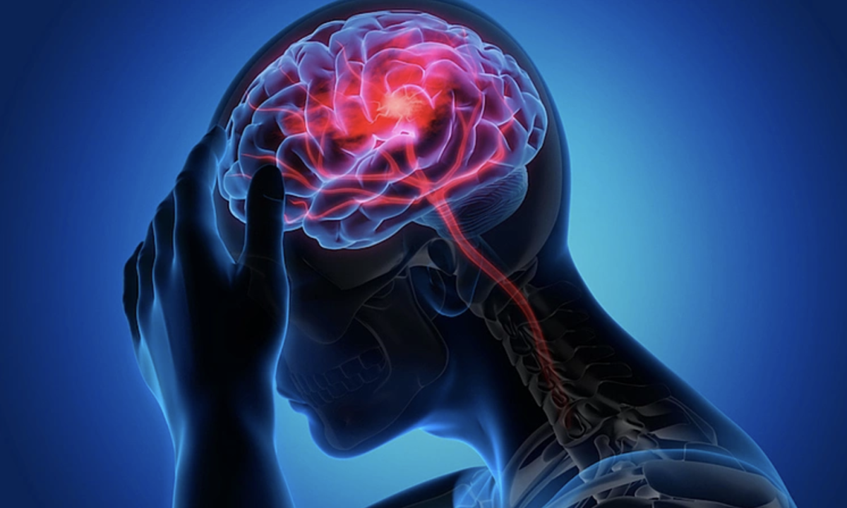 7 dấu hiệu cảnh báo nguy cơ đột quỵ