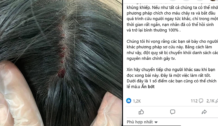 Cược mạng sống với 'mẹo chích máu chữa đột quỵ'