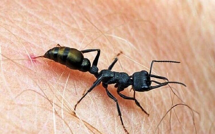 Sốc phản vệ sau khi bị kiến cắn