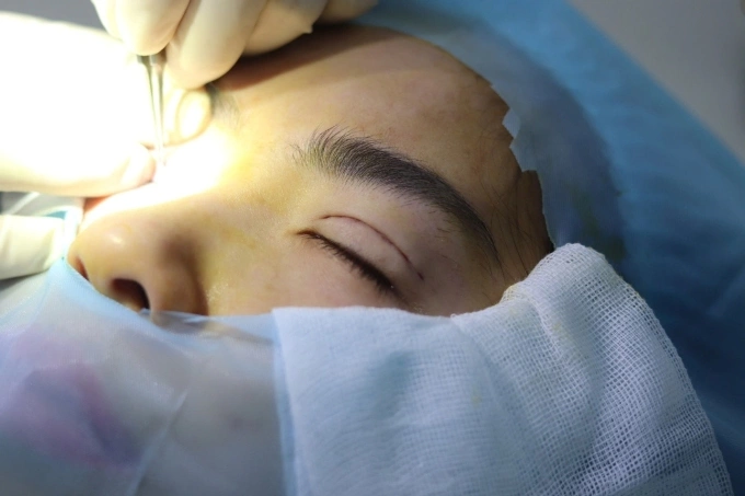 Khách hàng nên lựa chọn làm đẹp ở đơn vị uy tín, chất lượng. Ảnh: Dr. Ho Cao Vu