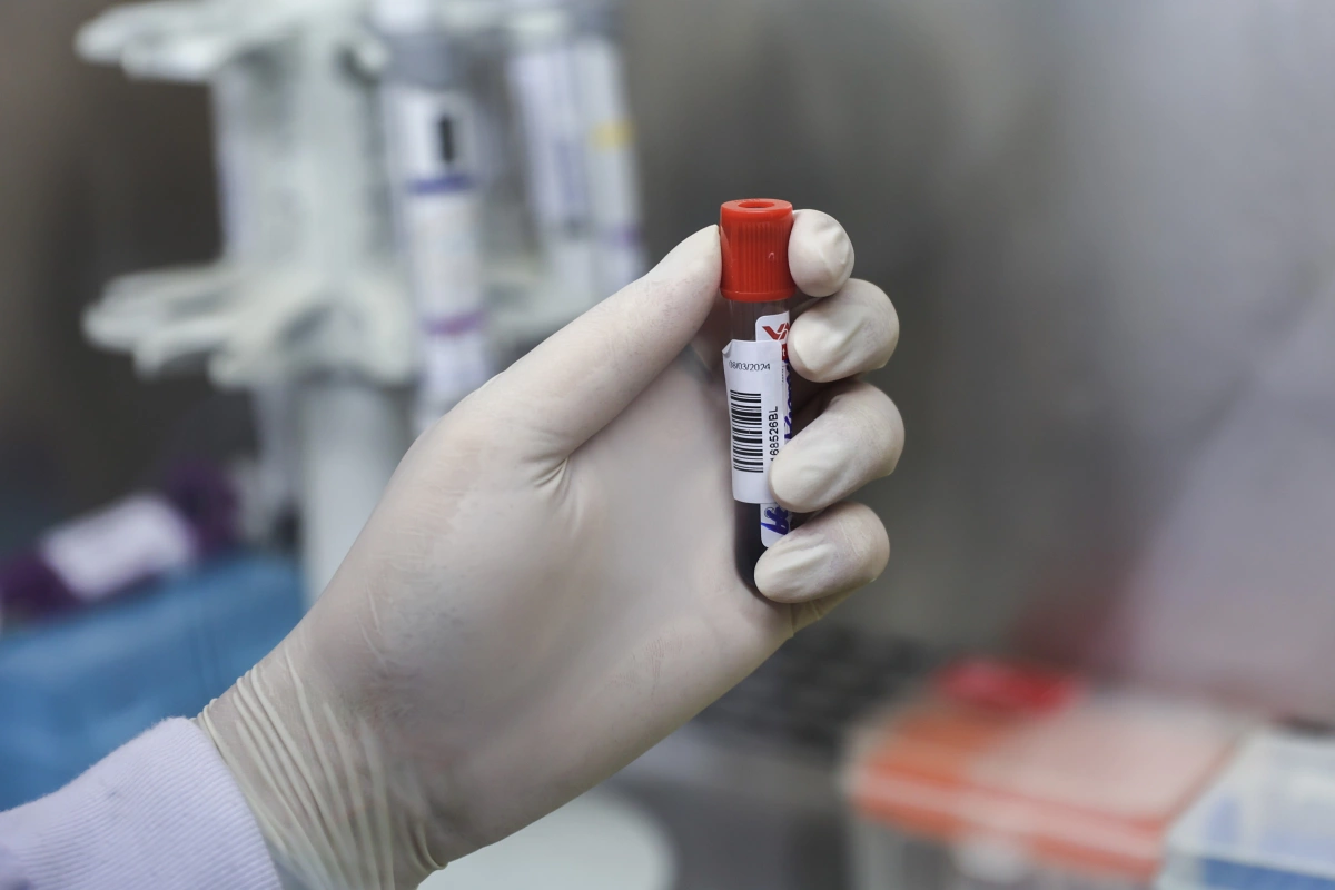 Loại enzyme 'bí ẩn' trong máu khiến trẻ bị chẩn đoán nhầm bệnh