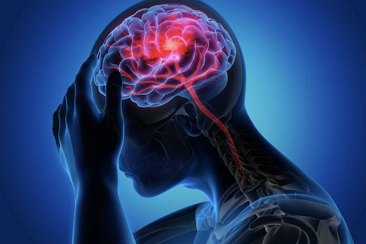 Đột quỵ và đột tử tim khác nhau thế nào?