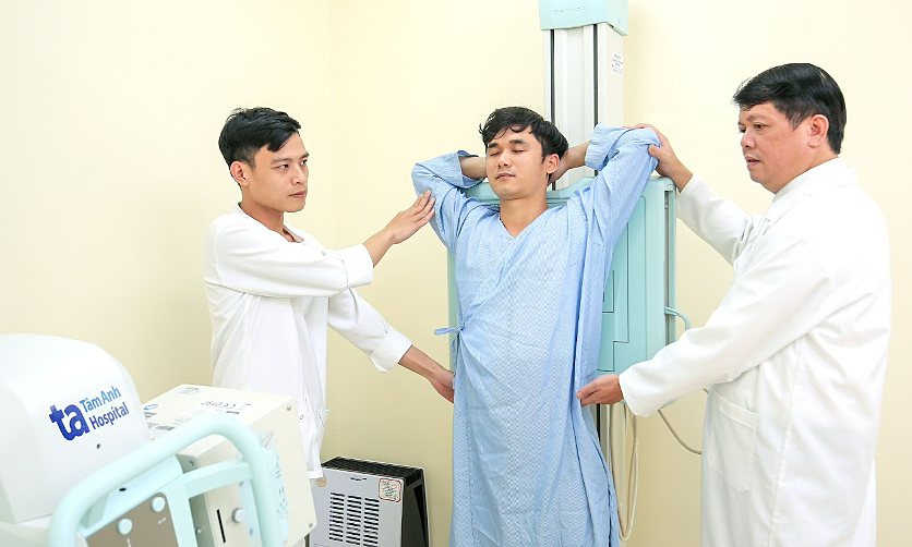 Chụp X-quang có phát hiện sớm ung thư phổi không?