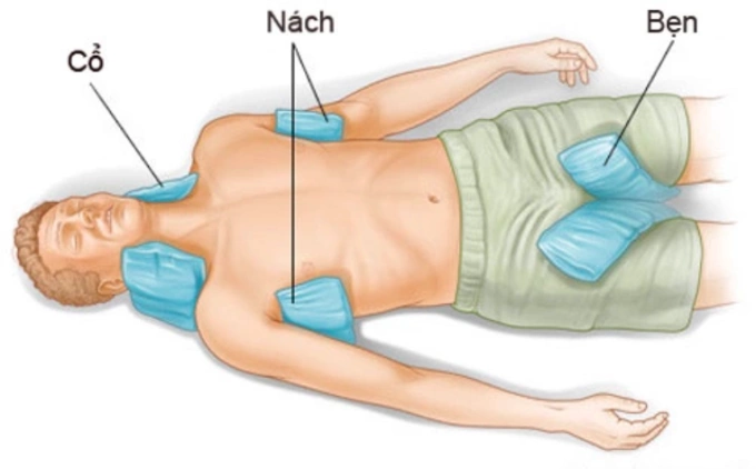 Để hạ nhiệt, nên áp khăn ẩm đắp vào nách, bẹn, cổ cho bệnh nhân say nắng. Ảnh: Examiner