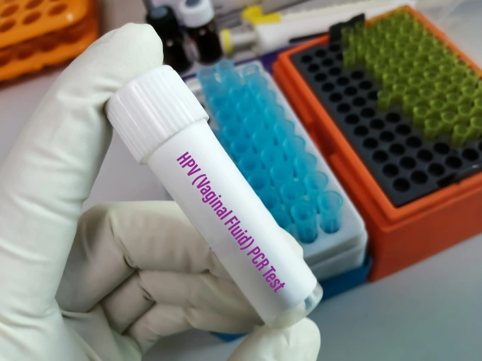 Minh họa ống xét nghiệm định týp HPV. Ảnh: Vecteezy