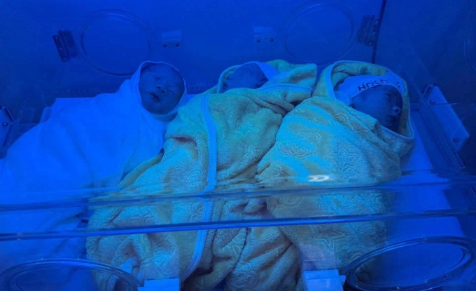 Ba bé chào đời khỏe mạnh. Ảnh: Bệnh viện cung cấp