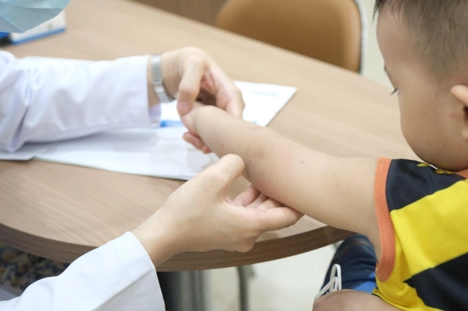 Bác sĩ đang kiểm tra vết muỗi đốt trên cánh tay bệnh nhi. Ảnh minh họa: Phòng khám đa khoa Tâm Anh Quận 7.