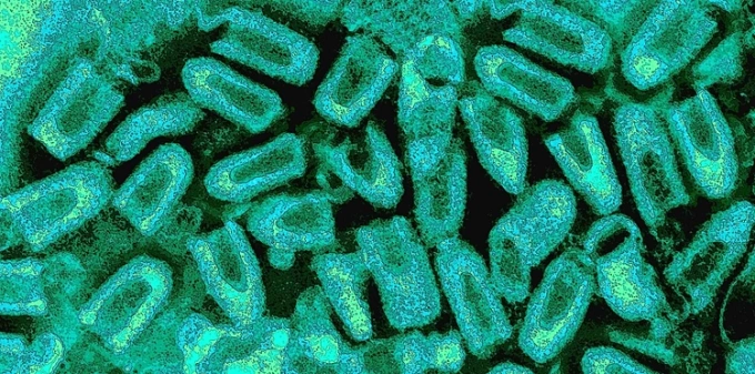 Virus gây bệnh dại dưới kính hiển vi. Ảnh: UTMB Edu