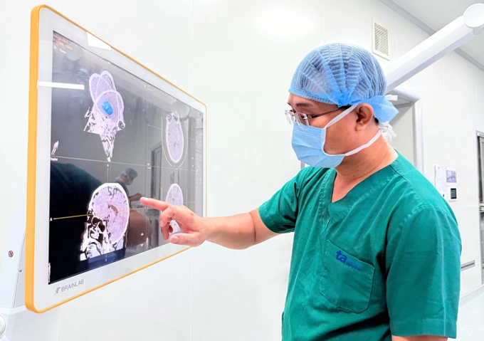 Bác sĩ xem hình ảnh 3D sọ não trước khi phẫu thuật. Ảnh: Bệnh viện Đa khoa Tâm Anh