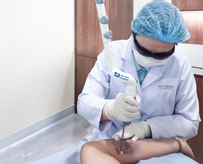 Bác sĩ sử dụng laser pico xóa xăm cho anh Dinh. Ảnh: Bệnh viện Đa khoa Tâm Anh