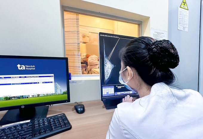 Nhân viên y tế đang lấy mẫu sinh thiết cho chị Thu. Ảnh: Bệnh viện Đa khoa Tâm Anh