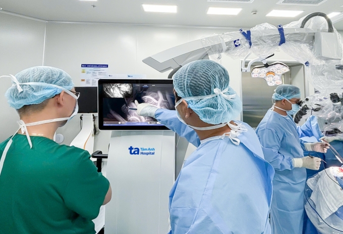 Bác sĩ theo dõi phẫu thuật u não chèn ép dây thần kinh số 7 bằng kính vi phẫu tích hợp AI. Ảnh: Bệnh viện Đa khoa Tâm Anh