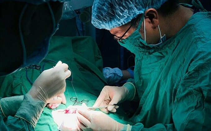 Bác sĩ phẫu thuật cho bệnh nhân. Ảnh: Bác sĩ cung cấp