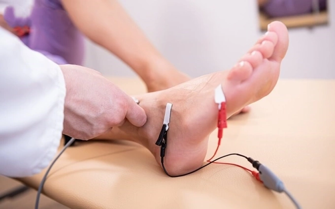 Đo điện cơ chân để đánh giá chức năng của cơ và thần kinh. Ảnh: Bệnh viện Đa khoa Tâm Anh
