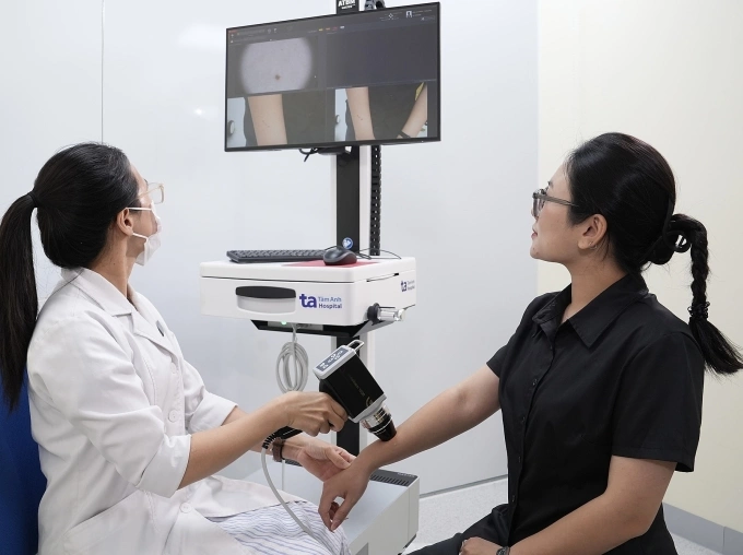Bác sĩ soi da để chẩn đoán bệnh lý da liễu cho một phụ nữ. Ảnh minh họa: Bệnh viện Đa khoa Tâm Anh