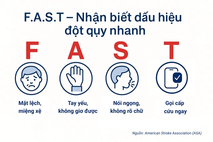 Nhận diện đột quỵ theo quy tắc F.A.S.T. Đồ họa: Hoàn Mỹ
