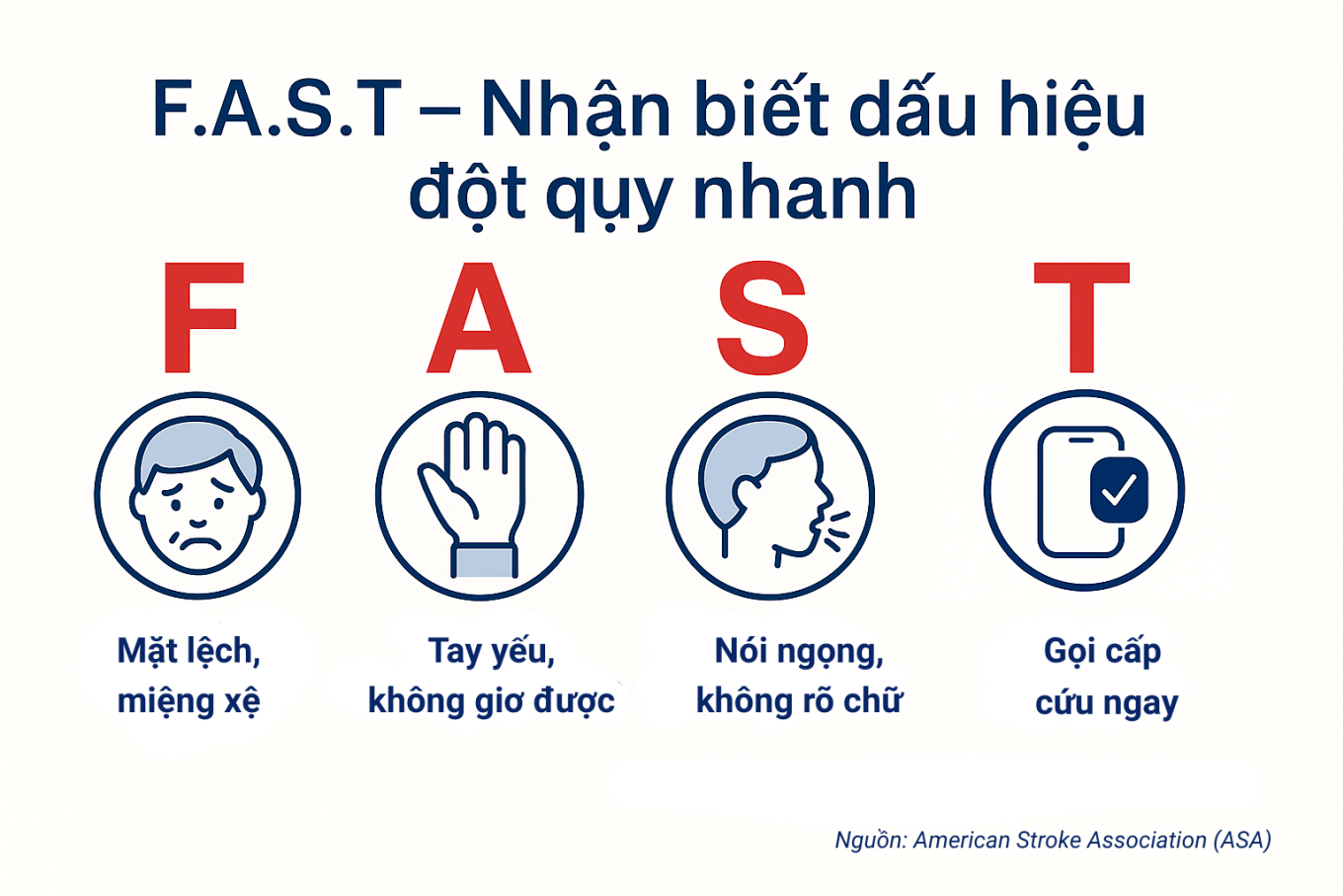 Nhận biết sớm đột quỵ với quy tắc F.A.S.T - Báo VnExpress Sức khỏe