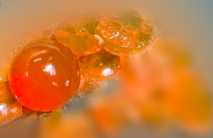 Dị vật được lấy ra là những hạt nhựa nhỏ, có khả năng trương nở khi gặp nước. Ảnh: Bệnh viện cung cấp