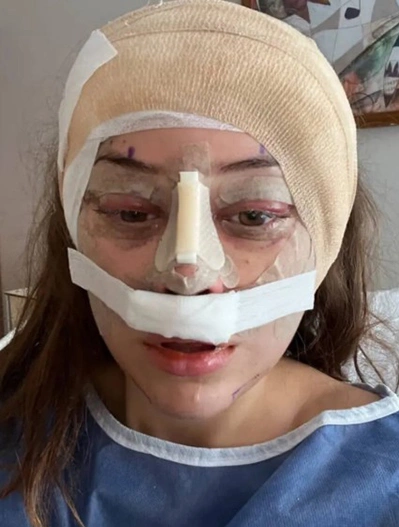 Cipryk là một trong ngày càng nhiều phụ nữ lựa chọn các thủ thuật xâm lấn chuyên sâu để ngăn chặn dấu hiệu lão hóa. Ảnh: @hotgirlenhancements