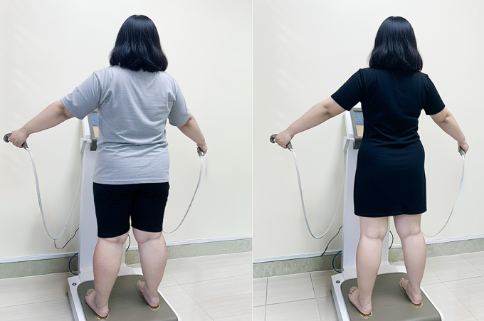 Trúc đã giảm 9 kg sau một tháng điều trị. Ảnh: Bệnh viện Đa khoa Tâm Anh