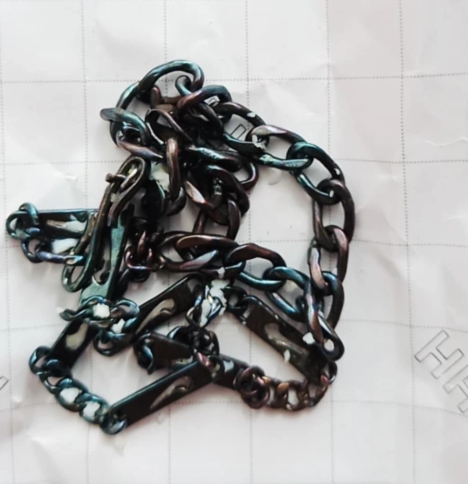 Dây bạc đổi màu sau khi được một bệnh nhân dùng đánh cảm. Ảnh: Nhân vật cung cấp