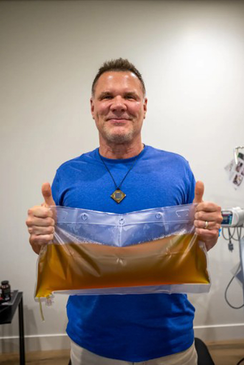 Cơn sốt lọc máu chống lão hóa của giới siêu giàu Van Es khoe phần huyết tương cũ, được rút ra khỏi cơ thể ông sau gần ba giờ. Ảnh: NY Post