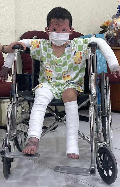 Bé trai tại Bệnh viện Nhi đồng 1, ngày 28/11. Ảnh: Thu Linh