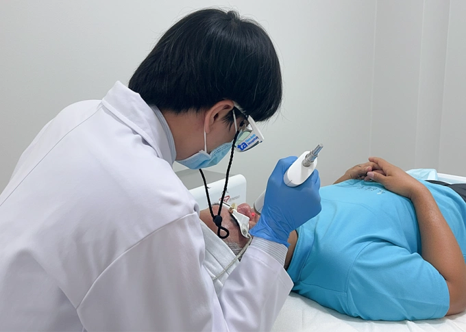 Mặt đỏ do giãn mạch máu Bác sĩ sử dụng laser YAG xung dài điều trị các mao mạch giãn cho ông Hưng. Ảnh: Bệnh viện Đa khoa Tâm Anh