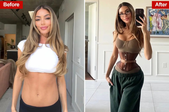 Những cô gái cắt xương sườn tìm 'eo con kiến' Enna Schell khoe vòng eo trước và sau phẫu thuật. Ảnh: Enna Schell