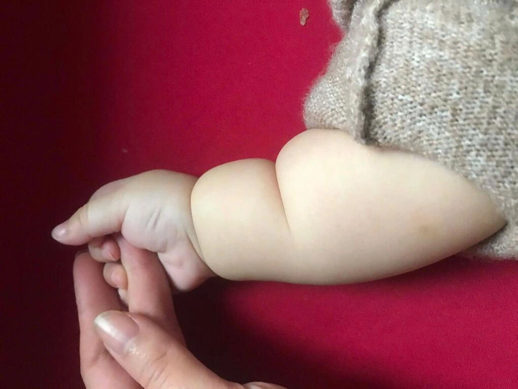 NGẤN CỔ TAY THỨ BA BÁO HIỆU VẬN MỆNH GIÀU SANG VÀ SỨC KHỎE DỒI DÀO