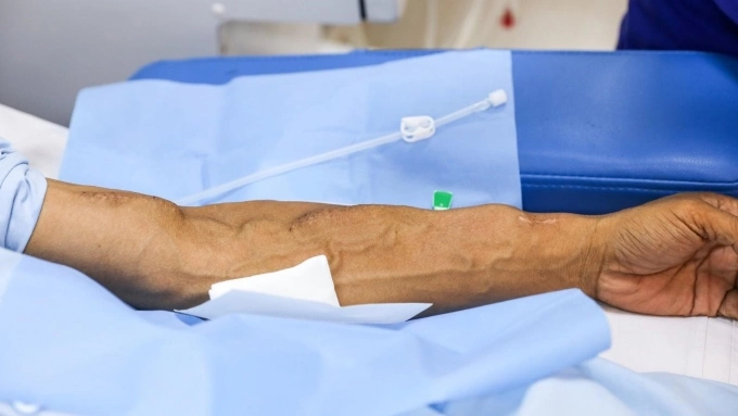 Câu chuyện 'sống khỏe' của người chạy thận nhân tạo Bệnh nhân chạy thận nhân tạo tại Bệnh viện Thống Nhất, TP HCM. Ảnh: Phùng Tiên