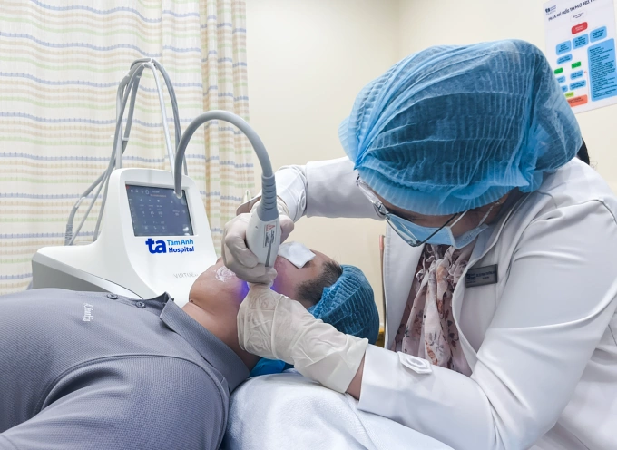 Kết hợp ba phương pháp trị sẹo rỗ mặt Bác sĩ sử dụng công nghệ RF điều trị sẹo rỗ cho anh Vũ. Ảnh: Phòng khám Đa khoa Tâm Anh Quận 7