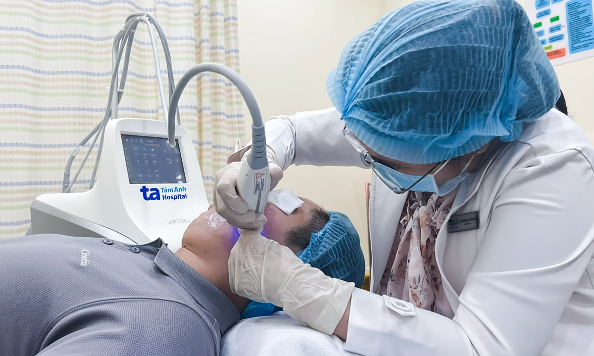 Kết hợp ba phương pháp trị sẹo rỗ mặt