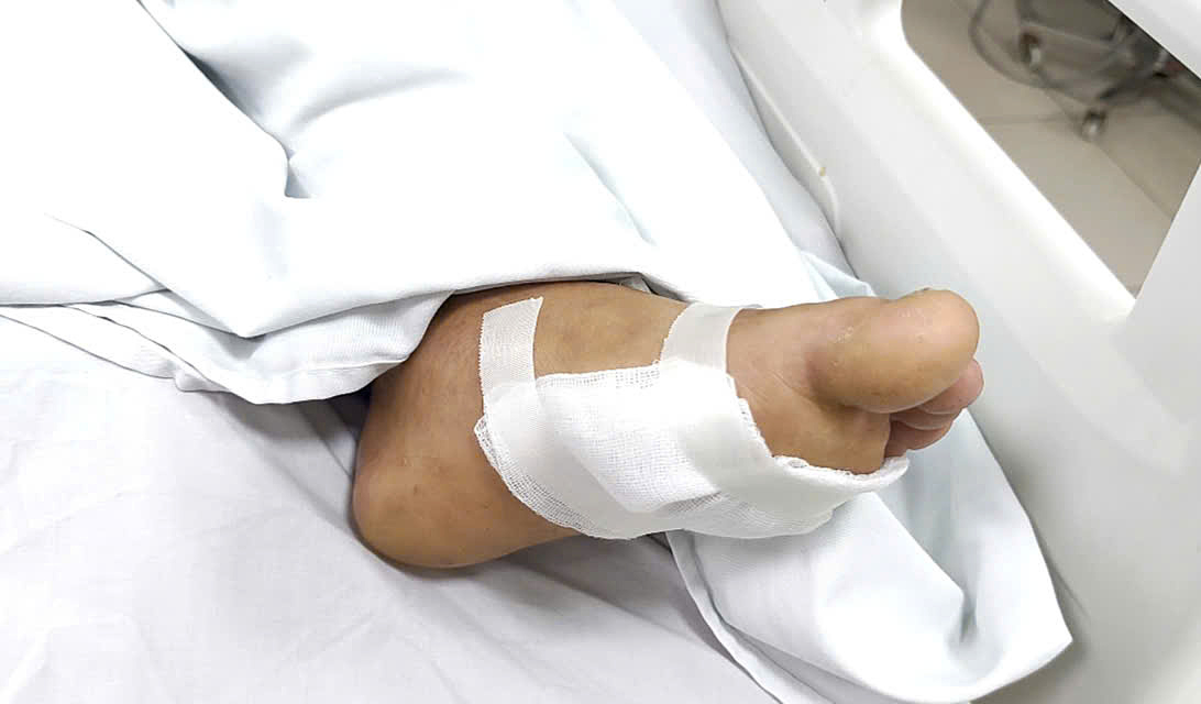 Vết xước nhỏ khiến người đàn ông nguy kịch