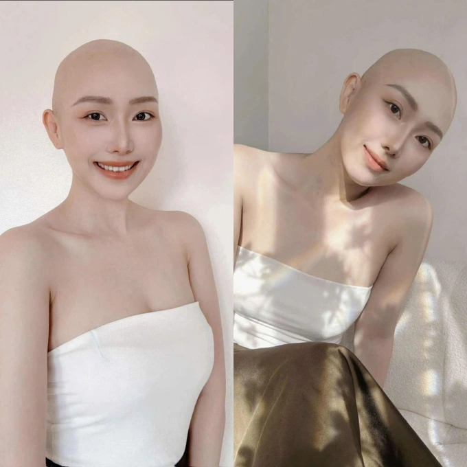 Cú sốc ung thư ở tuổi 28 Minh Anh trong bộ ảnh được bạn thân ghi lại. Ảnh: Nhân vật cung cấp