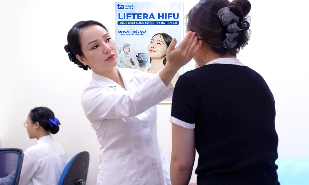 Trán vón cục sau 5 năm tiêm filler làm đẹp