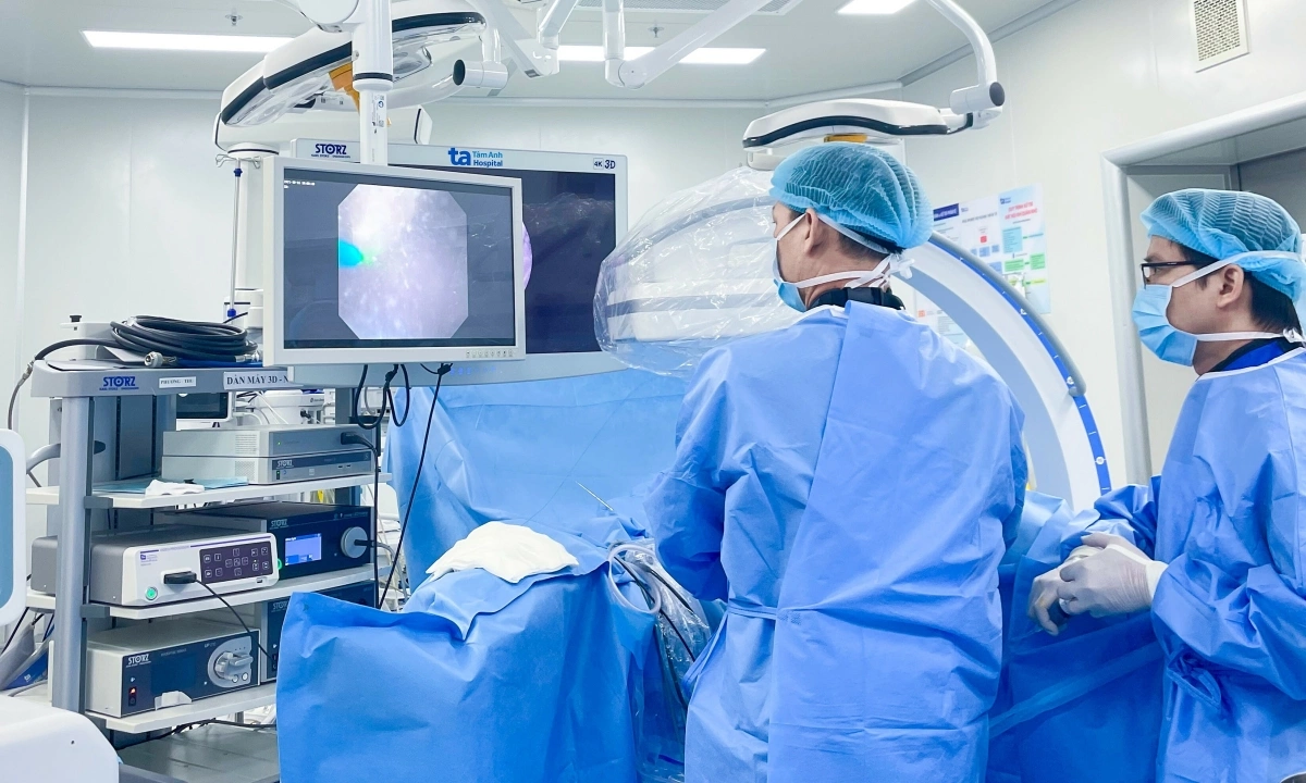 Đau quặn bụng do sỏi kẹt niệu quản