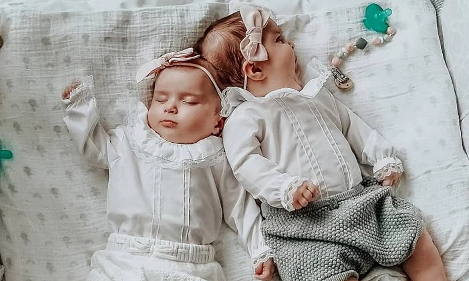 Cuộc sống của cặp song sinh dính đầu sau 6 năm tách rời