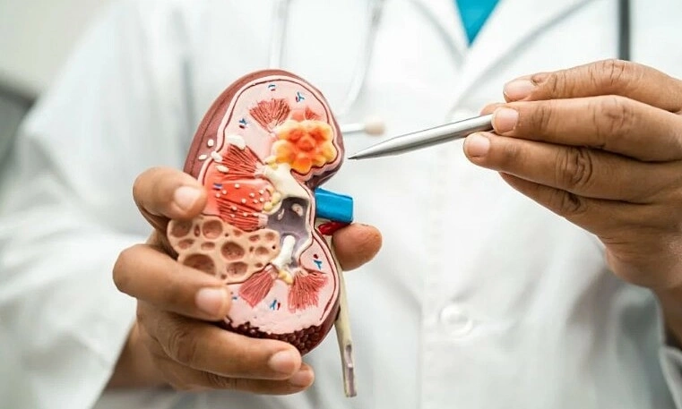 Món ăn được xem là "thuốc bổ" nhưng lại là khắc tinh của thận