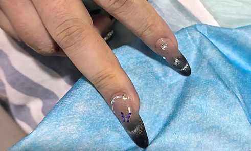 Gọi thợ làm móng đến phòng hồi sức để kịp cứu cô gái nguy kịch